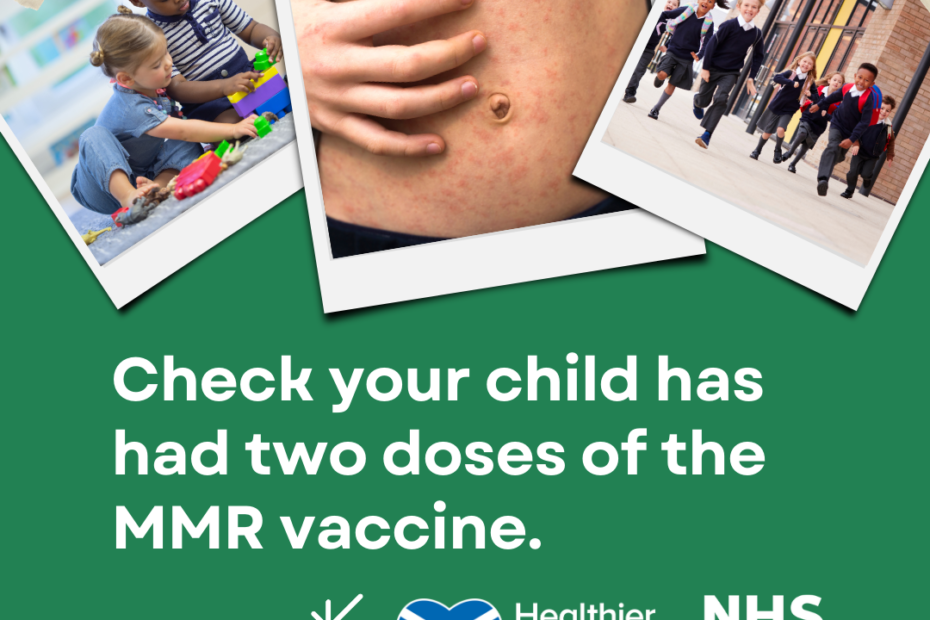 MMR against measles - images of measles rash and children