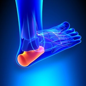 Plantar Fasciitis (MSK Patient Portal) - NHS Ayrshire & Arran