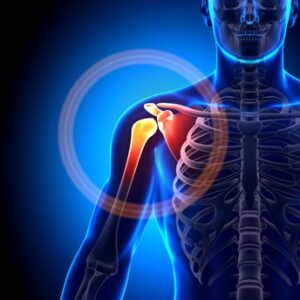 What’s Wrong with my Shoulder? – Weak and Painful Shoulder (MSK Patient ...